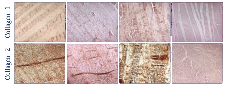 Immunohistochemical staining for collagen I and collagen II across four disc conditions.